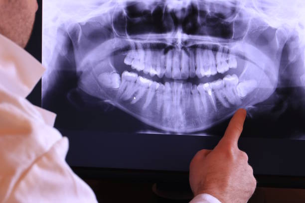 Best Urgent Care for Lost Fillings or Crowns in Oakland Park, FL